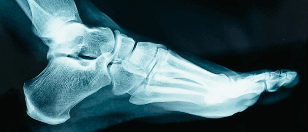 Lawyer for Accident at Work